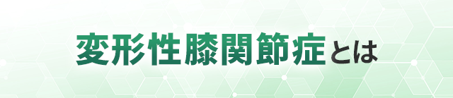 変形性膝関節症とは